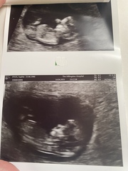 Gender 12 weeks
