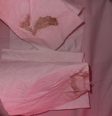 does this look like missed miscarriage?
