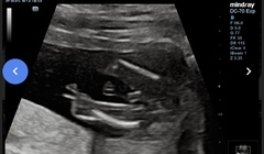 September 2021 - Thread 4