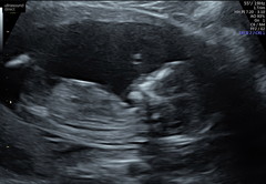 This is definitely a boy right?