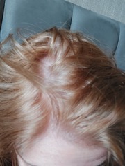 Should I embrace white hair at 47?