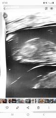 Nub theory 13 week scan