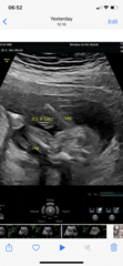 Unsure whether boy or girl?
