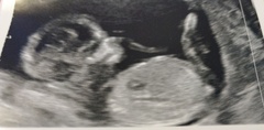 Gender Guesses 13+4