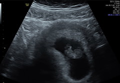9 week scan - gender guess?