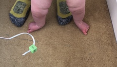 Baby’s foot turning out (pics)