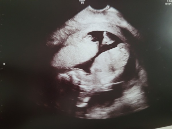 Any ideas if a boy or girl?