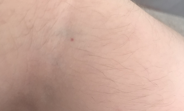 Any idea what this mark on my partner is please