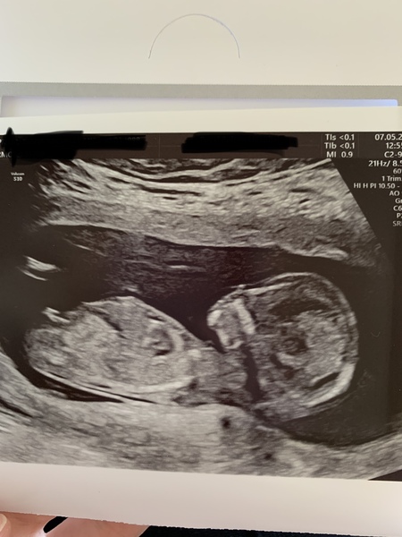 13w2d nub theory guesses