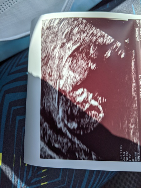 December babies 2021! Thread 3