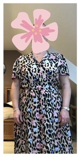 Which dress, or both?