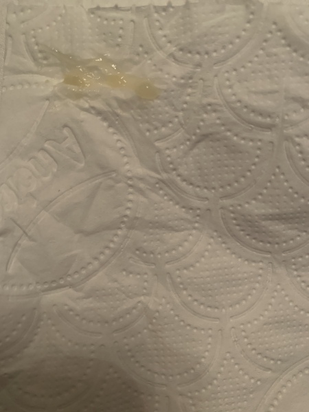 Is this the start of my mucus plug? Pic - TMI