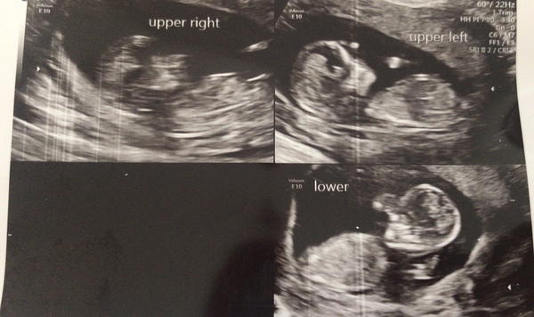 Due November 2021 - thread 2!