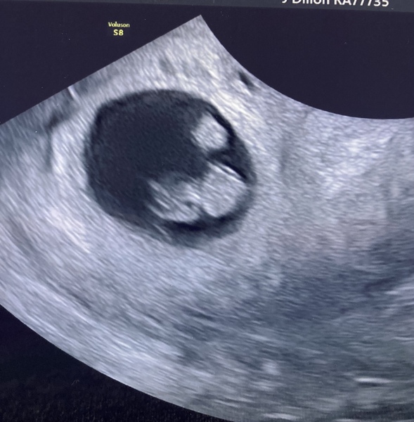 December babies 2021! Thread 3