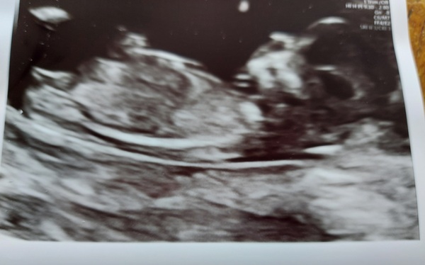 Nub guess,  13 weeks