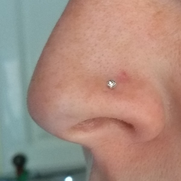 What is this on my nose?!