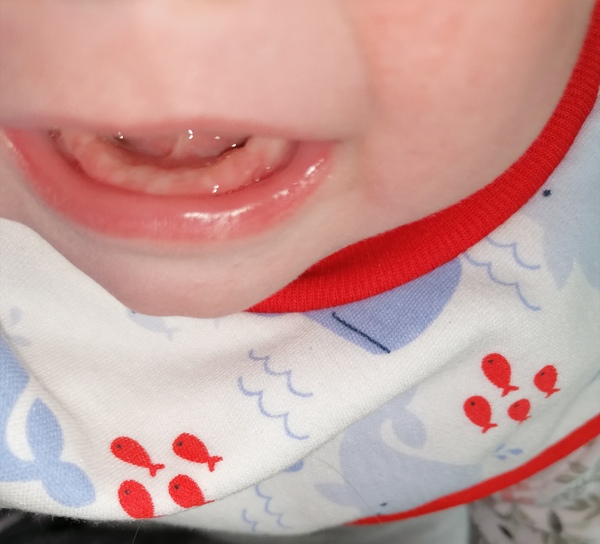 What's up with these gums (pic included)?
