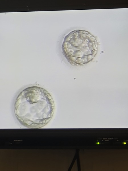 1st IVF mid April