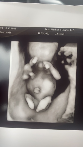 December babies 2021! Thread 3