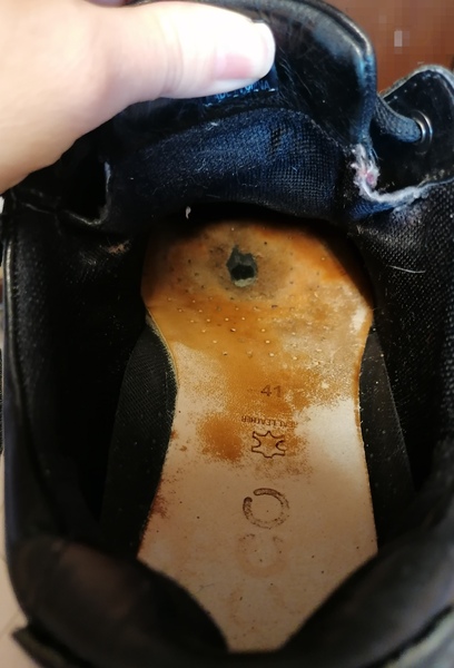Hole in one shoe - does this happen to anyone else