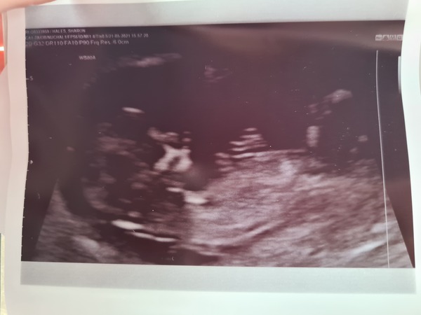 December babies 2021! Thread 4