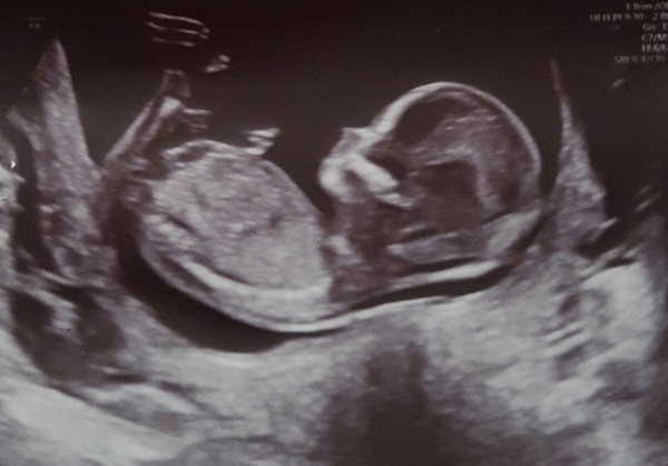 Due November 2021 - thread 2!