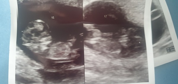 December babies 2021! Thread 4