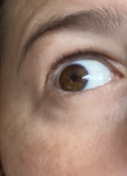 To think dark brown eyes aren’t common in white British people