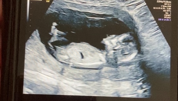 Due November 2021 - thread 2!