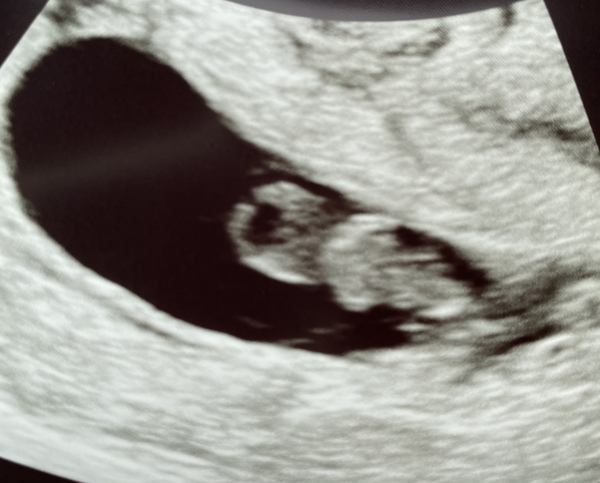 Christmas Baby's 2021