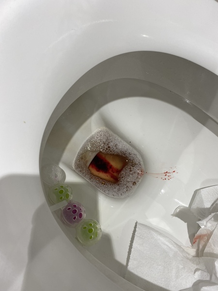 Have I miscarried? Explicit pic in thread!