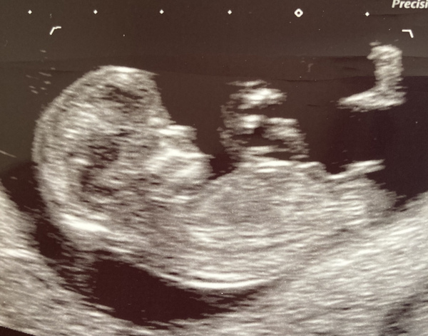 Due November 2021 - thread 2!