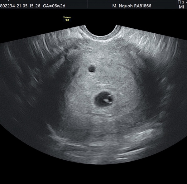 Is it twins? Help needed guys!!