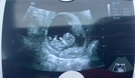 14 weeks - boy or girl? Guesses welcome!