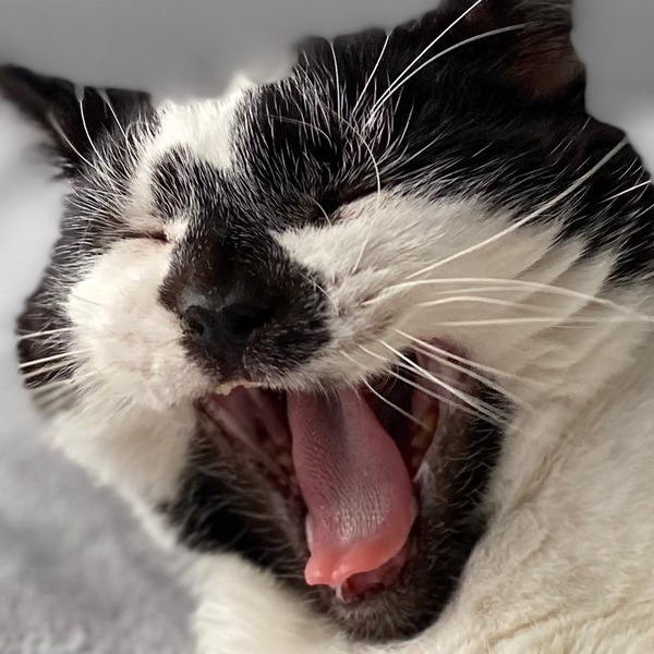 Please tell me about tooth extractions