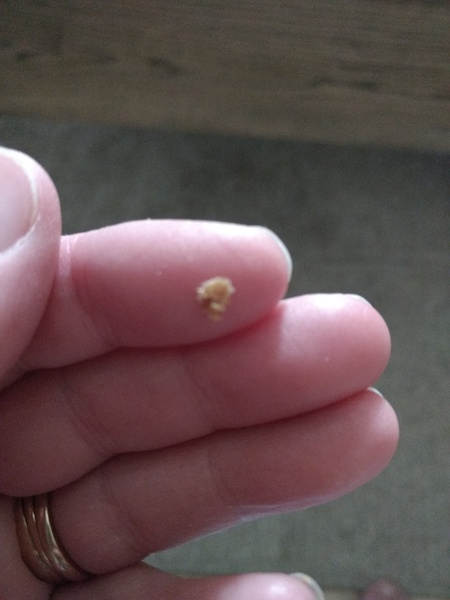 My ear has just produced this...