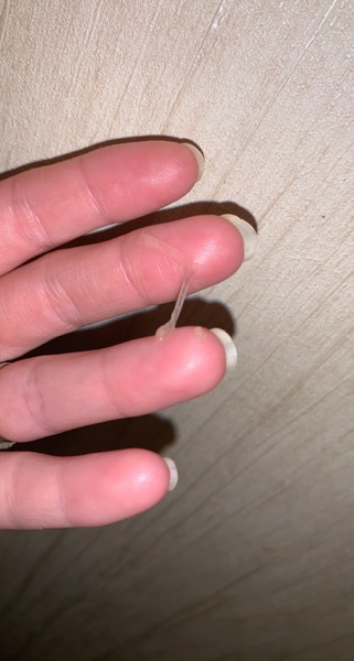 **warning photo** is this fertile discharge ?