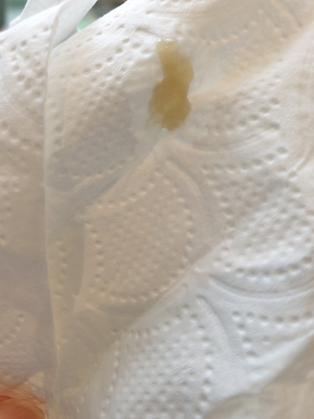 Is this my mucus plug? TMI..picture included!!!!
