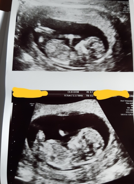 Due November 2021 - thread 2!