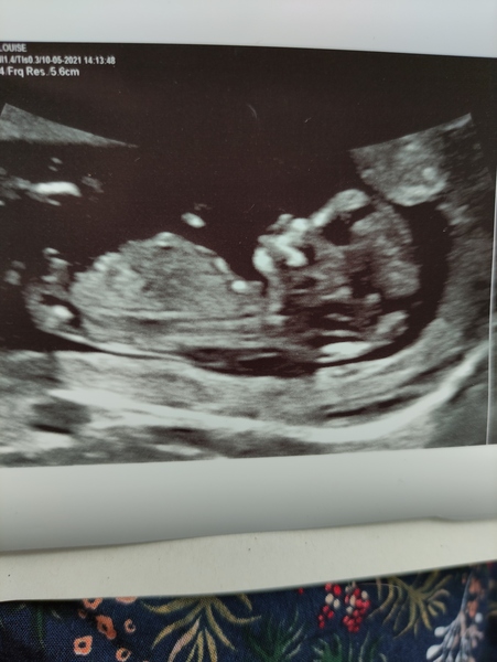 Due November 2021 - thread 2!