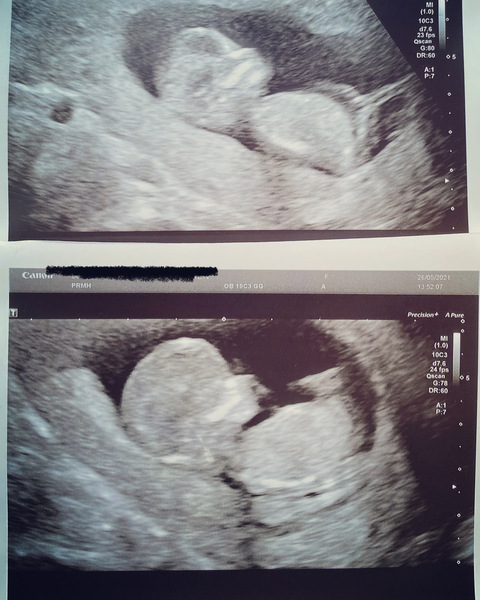 December babies 2021! Thread 4