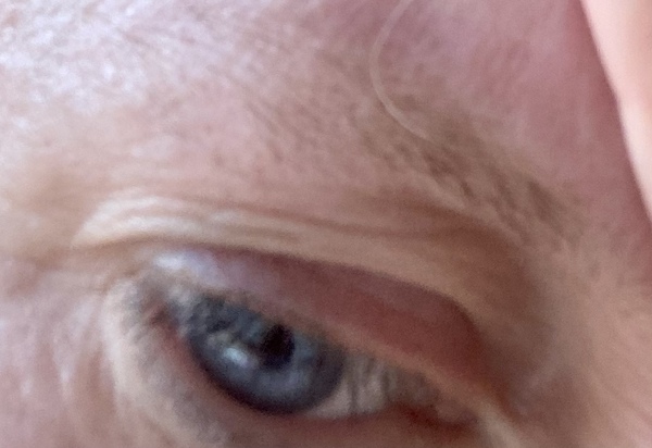 Horrible saggy non existence eyebrows