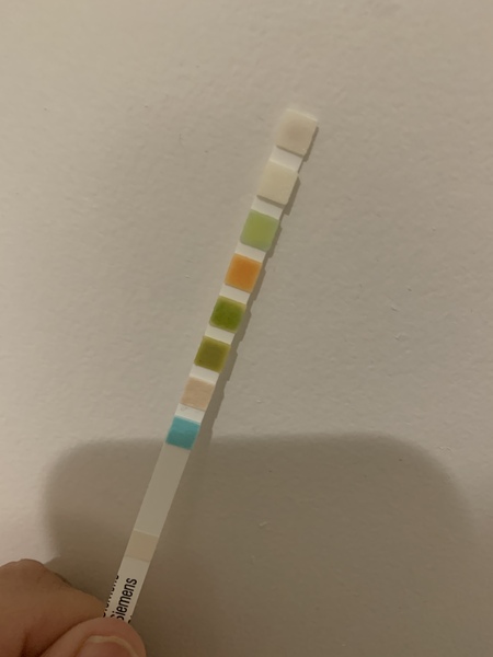 Blood in urine, kidney pain