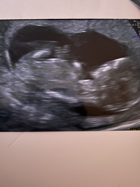 Gender guesses?