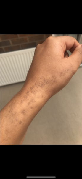 Anyone know what this on my skin is? Pic included