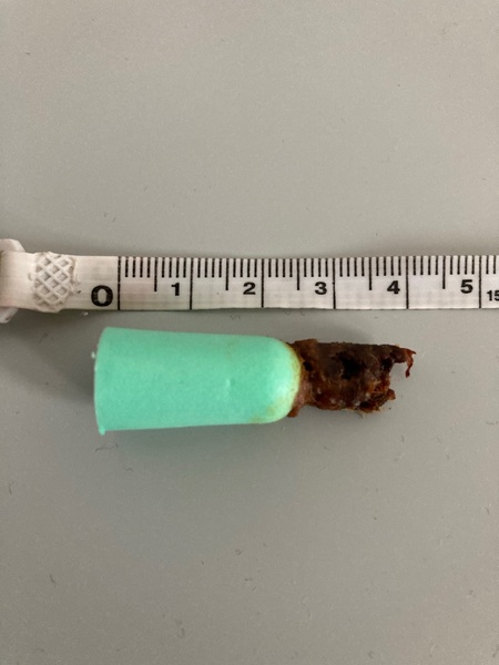 Look what just came out with my earplug!