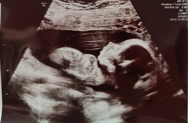September 2021 Thread 5 (half way there!)