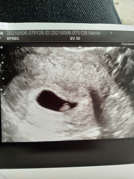 December babies 2021! Thread 3