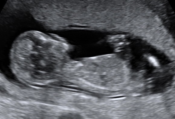 Gender guess?