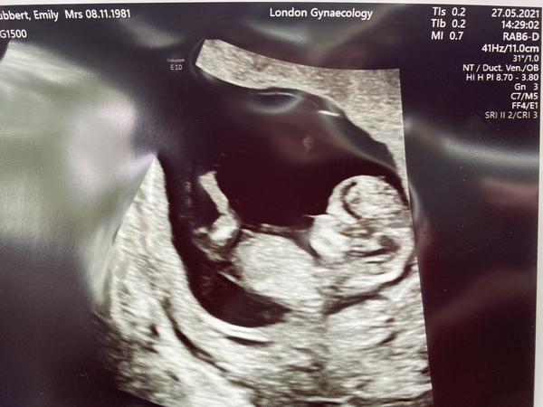 TTC after MC - May 2021 thread 19